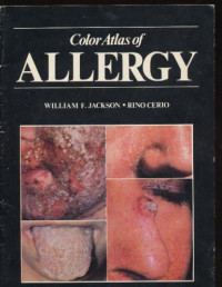 Image of Color Atlas Of Allergy